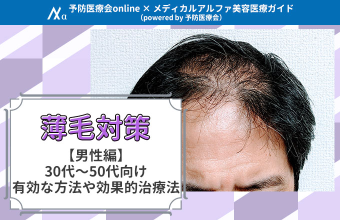 男性編】薄毛対策○選！30代〜50代向け有効な方法や効果的治療法も | メディカルアルファ美容医療ガイド