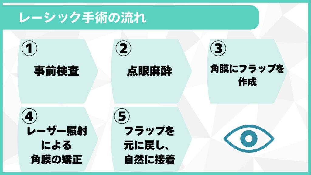 レーシック手術の流れ