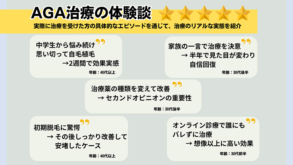 AGA治療の体験談