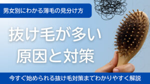 抜け毛が多い原因と対策｜男女別にわかる薄毛の見分け方