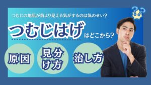 頭頂部の薄毛（つむじはげ）はどこから？原因・治し方・見分け方