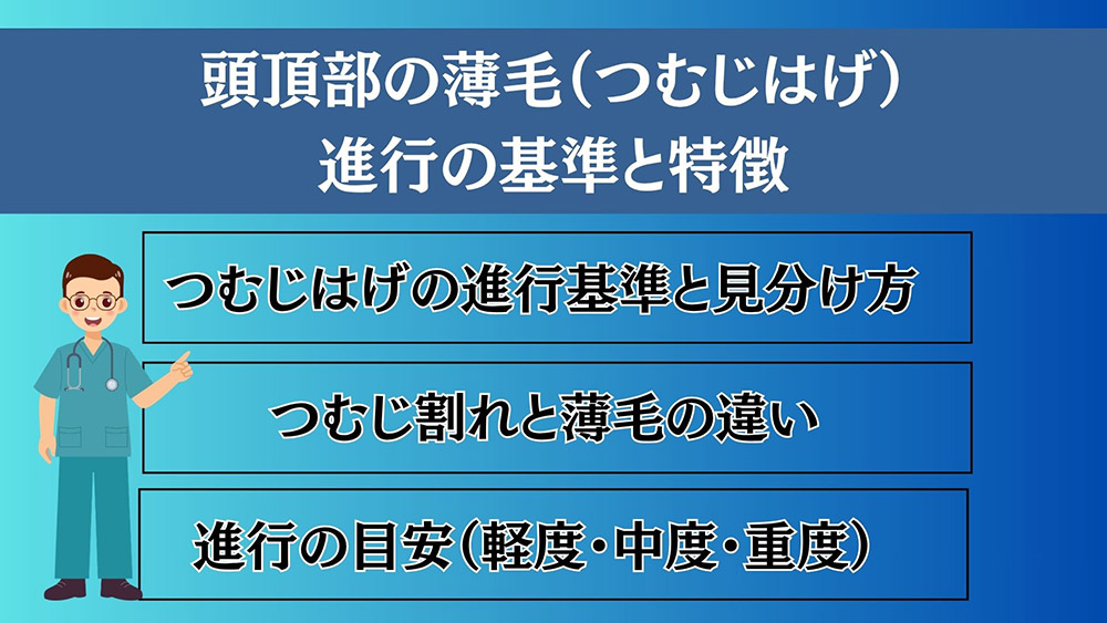 頭頂部の薄毛(つむじはげ)はどこから?進行の基準と特徴