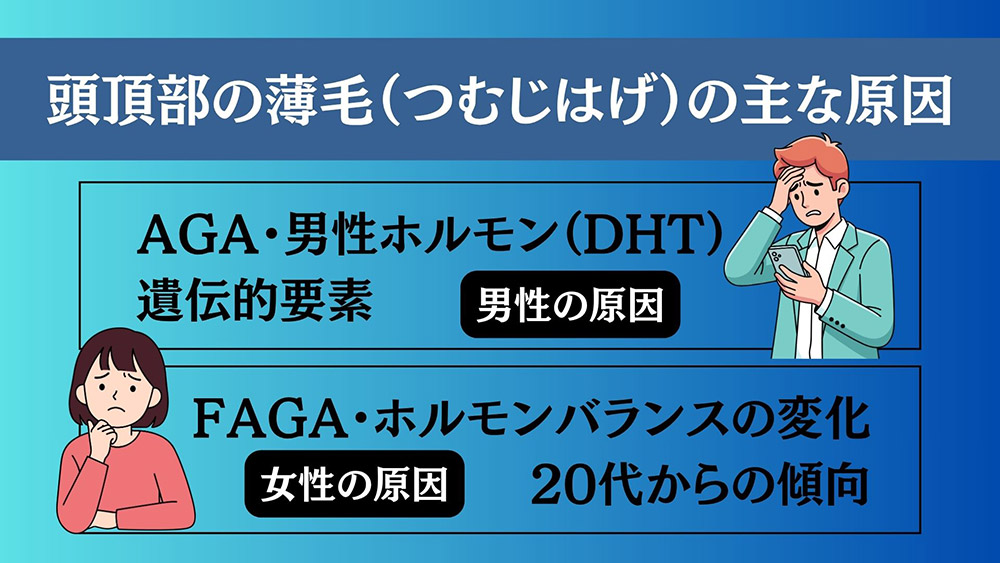 頭頂部の薄毛(つむじはげ)の主な原因