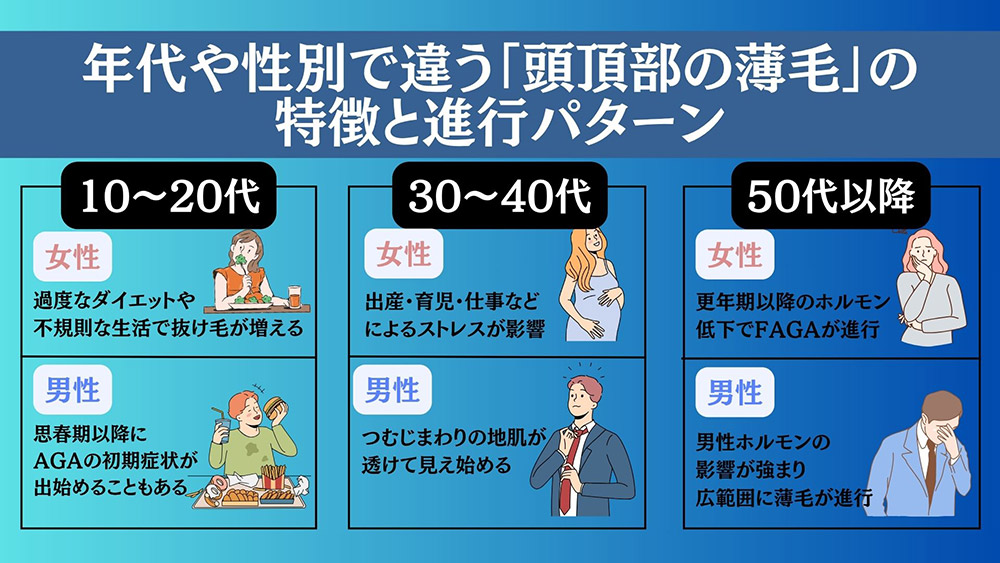 年代や性別で違う「頭頂部の薄毛」の特徴と進行パターン
